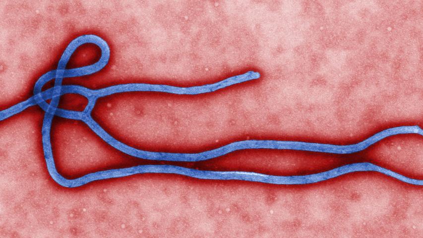 Mithilfe von 3D-Bildern haben am 18. November Wissenschaftler in den USA die möglichen Schwachstellen des Ebola-Virus entdeckt. Die Hoffnung auf bald bessere Medikamente wird größer.