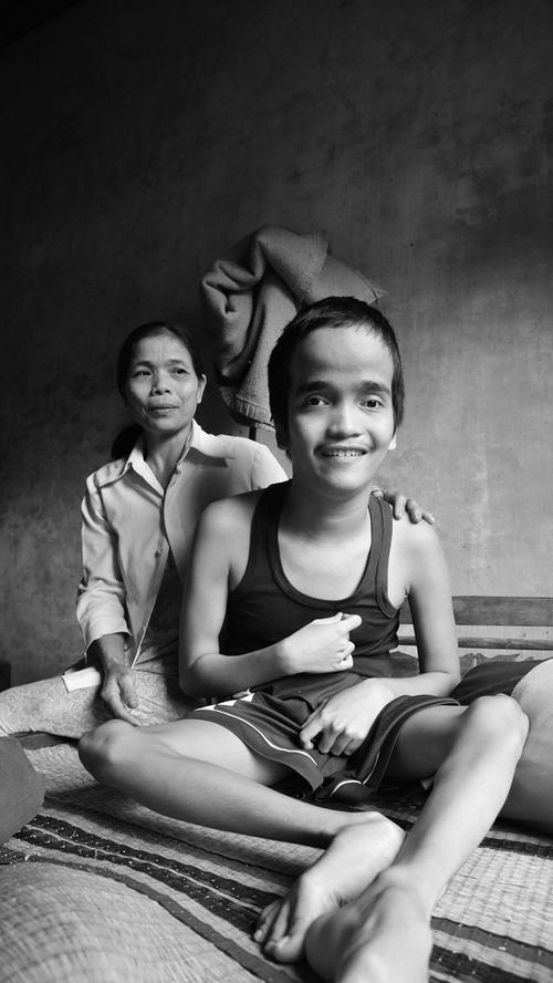 "Wenn ich nur wüsste, wie ich mehr für meinen Sohn tun kann. Es schmerzt furchtbar, dass ich hilflos bin." Huyn Thi Le, 42 Jahre, Mutter von Nguyen Hoang Hoai Tan, 18 Jahre, und mutmaßliches Agent Orange Opfer.