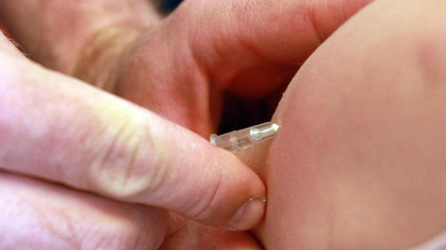 Masern sind zurück: Fürther Chefarzt rät zur Impfung