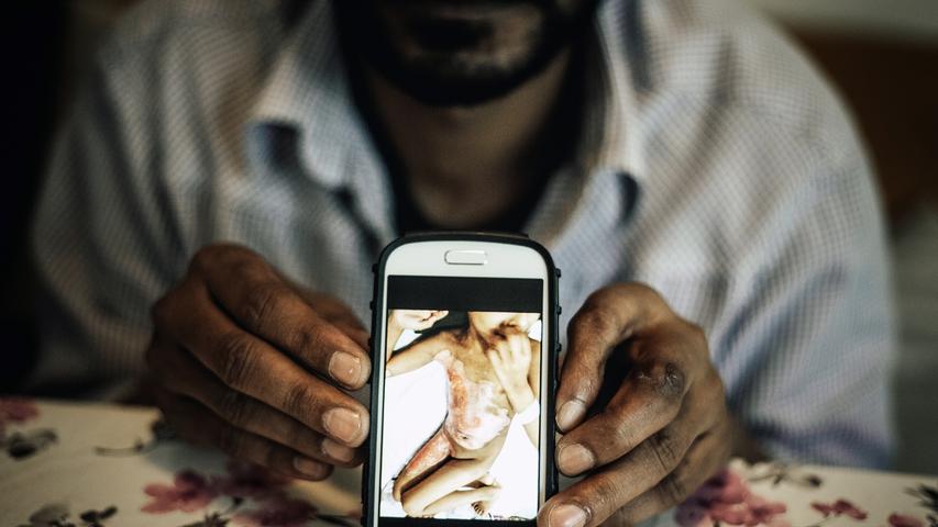 Aus rund 800 eingereichten Bildern wurde dieses Motiv des freien Fotografen Florian Bachmeier aus Schliersee zum bayerischen Pressefoto 2015 gekürt. Es zeigt das Handyfoto eines pakistanischen Flüchtlings, dessen Tochter bei einem Brandunfall schwer verletzt wurde.
