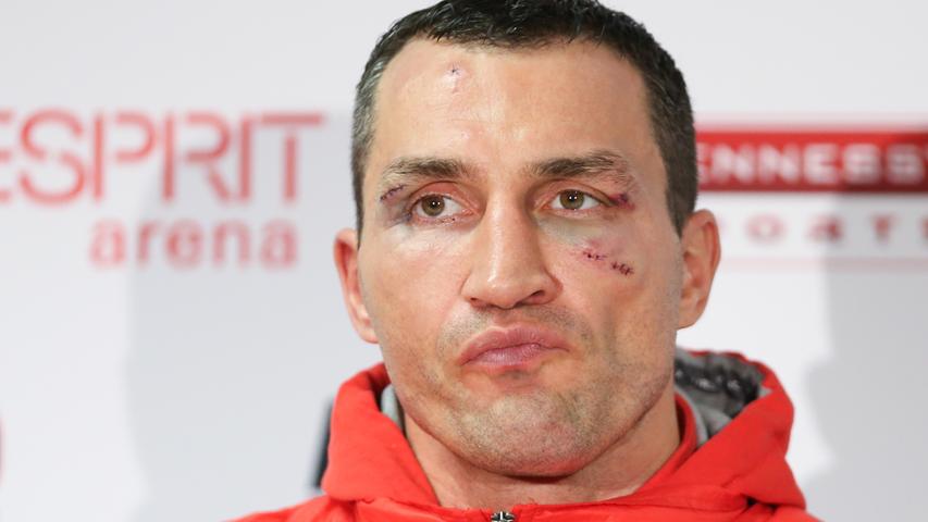 Fury verdrischt Klitschko: Bilder einer Niederlage