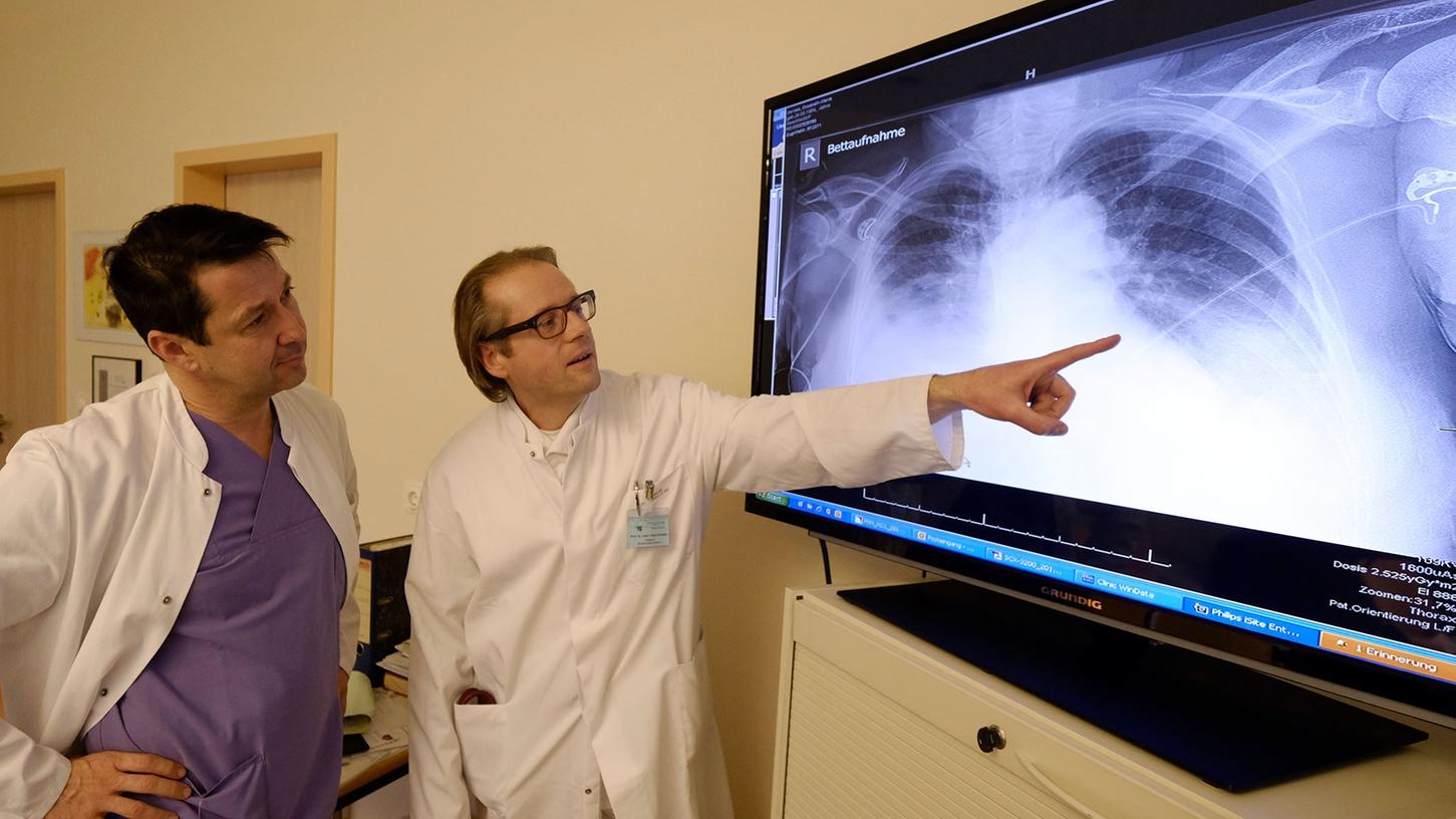 Prof. Peter Hubert Grewe (li.) und Prof. Claus Schäfer deuten ein Röntgenbild, auf dem eine Lungenentzündung zu sehen ist.