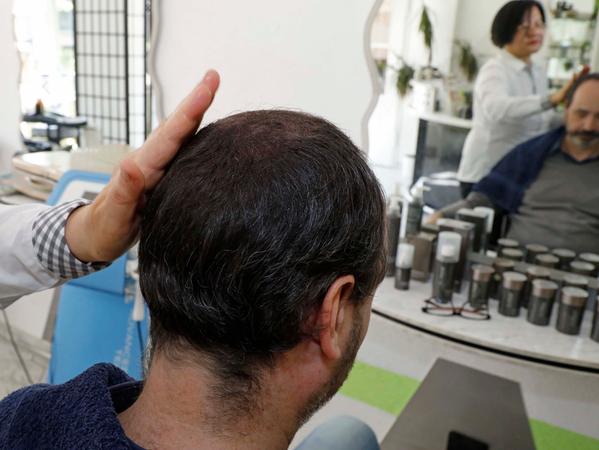Kampf gegen die Glatze: So verdecken Sie kahle Stellen