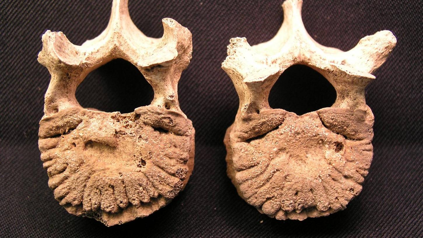 Die Grabungen brachten unter anderem diese Knochen zum Vorschein: Sie gehören einem Jugendlichen aus dem 17. beziehungsweise 18. Jahrhunert. Zwischen dem  11. und 12. Brustwirbel sind degenerative Veränderungen sichtbar.