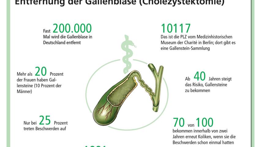 Die Auswertung der Uni Erlangen-Nürnberg ergibt, dass die Gallenblase am besten im Nürnberger Nordklinikum entfernt wird.