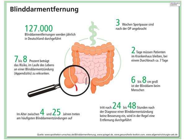 Blinddarm-OP: Uni-Klinik Erlangen siegt im NZ-Klinikcheck