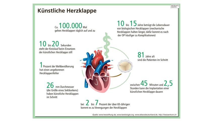 In der Region gibt es zwei Kliniken, die diesen Eingriff durchführen - und beide, das Südklinikum in Nürnberg und die Erlanger Uniklinik, schneiden in der Auswertung gut ab.