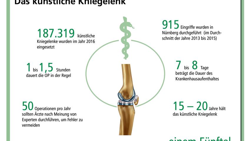 In Sachen künstliche Gelenke steht die Erler-Klinik gleich zweimal an der Spitze: Das Nürnberger Krankenhaus erhielt die beste Bewertung für die  Knieprothese...