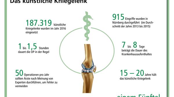 In Sachen künstliche Gelenke steht die Erler-Klinik gleich zweimal an der Spitze: Das Nürnberger Krankenhaus erhielt die beste Bewertung für die Knieprothese...