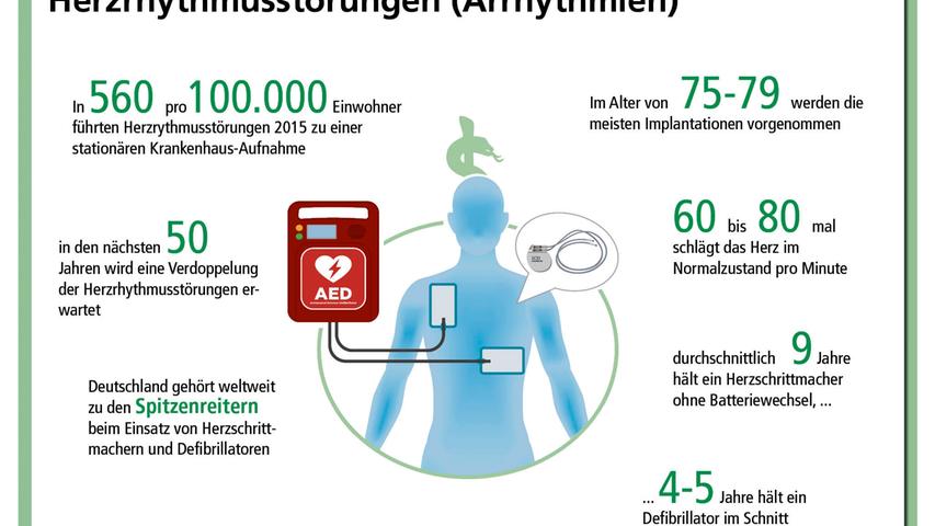 Bei der Implantation von Herzschrittmachern und Defibrillatoren steht das Nürnberger Krankenhaus Martha-Maria an der Spitze.