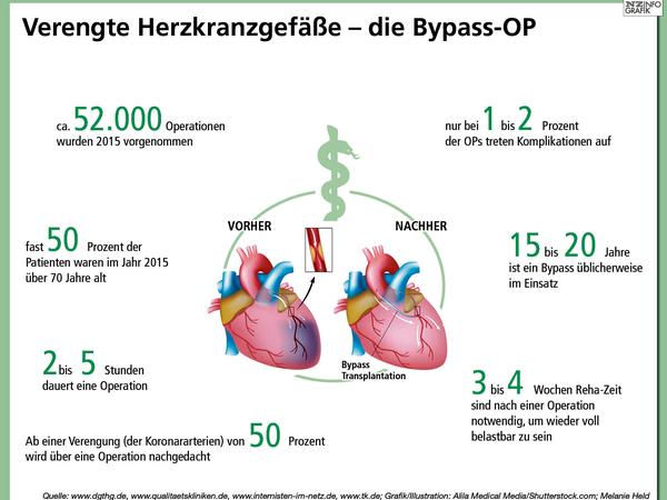 NZ-Klinikcheck: Zwei Spitzenadressen für Bypass-OP