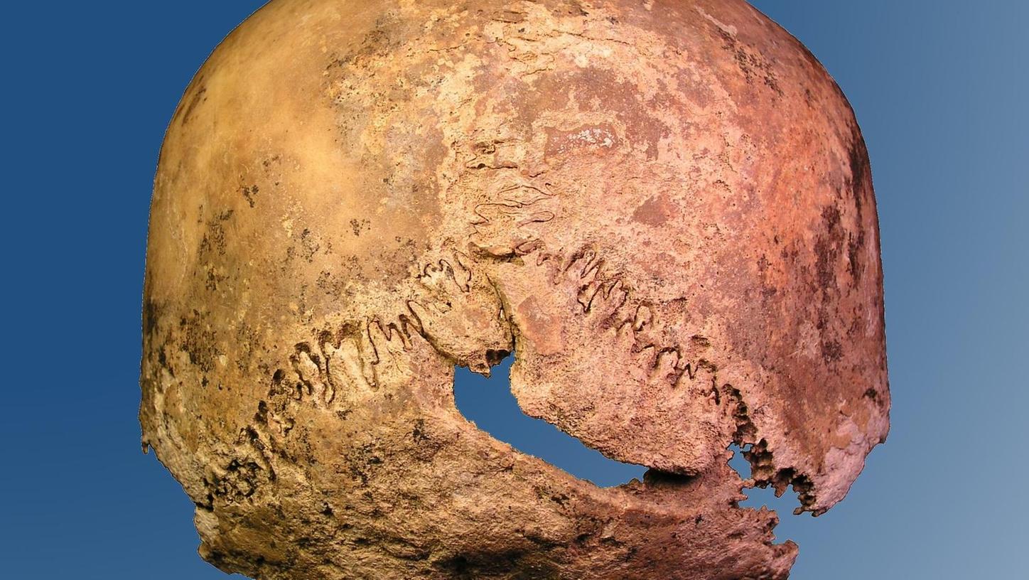 Bei den Knochen aus Grab Nr. 20 lag dieser Schädel. Deutlich ist die Hiebverletzung am Hinterkopf zu sehen. Nun rekonstruieren Historiker einen Mordfall – saß der Auftraggeber womöglich in Nürnberg?
