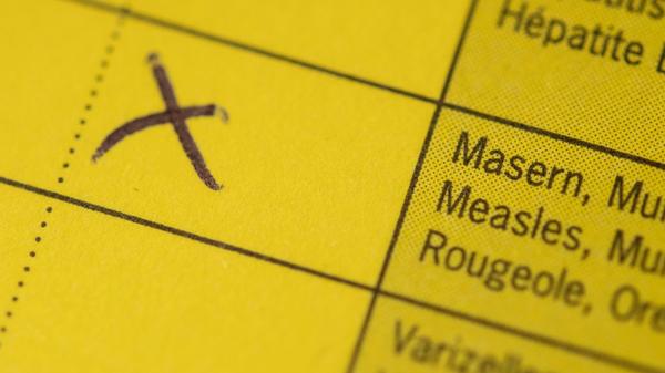 Das Tückische an den Masern ist, dass die ersten Symptome erst acht bis zehn Tage nach der Ansteckung auftreten. Der Hautausschlag kommt oft erst nach 14 Tagen zum Vorschein - bereits drei bis fünf Tage zuvor sind Erkrankte ansteckend. Sobald der Ausschlag sichtbar wird, ist der Patient noch vier Tage lang ansteckend.