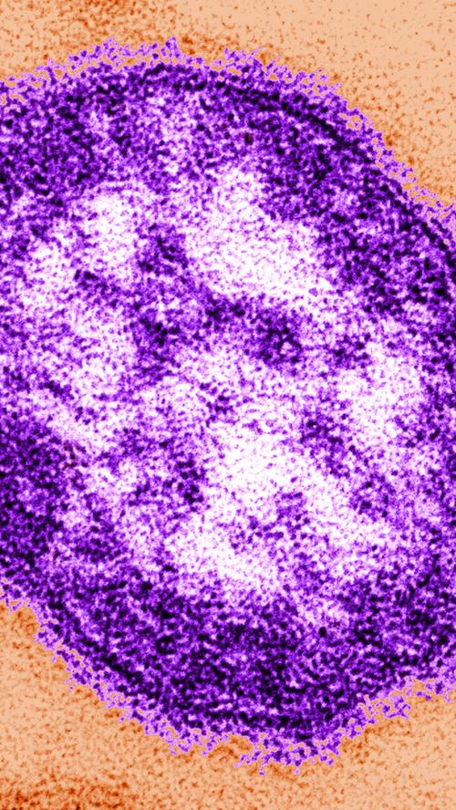 Die Masern sind eine Infektionskrankheit, die durch Viren ausgelöst wird. Sie ist hochansteckend und betrifft in der Regel Kinder. Im schlimmsten Fall kann sie tödlich enden.