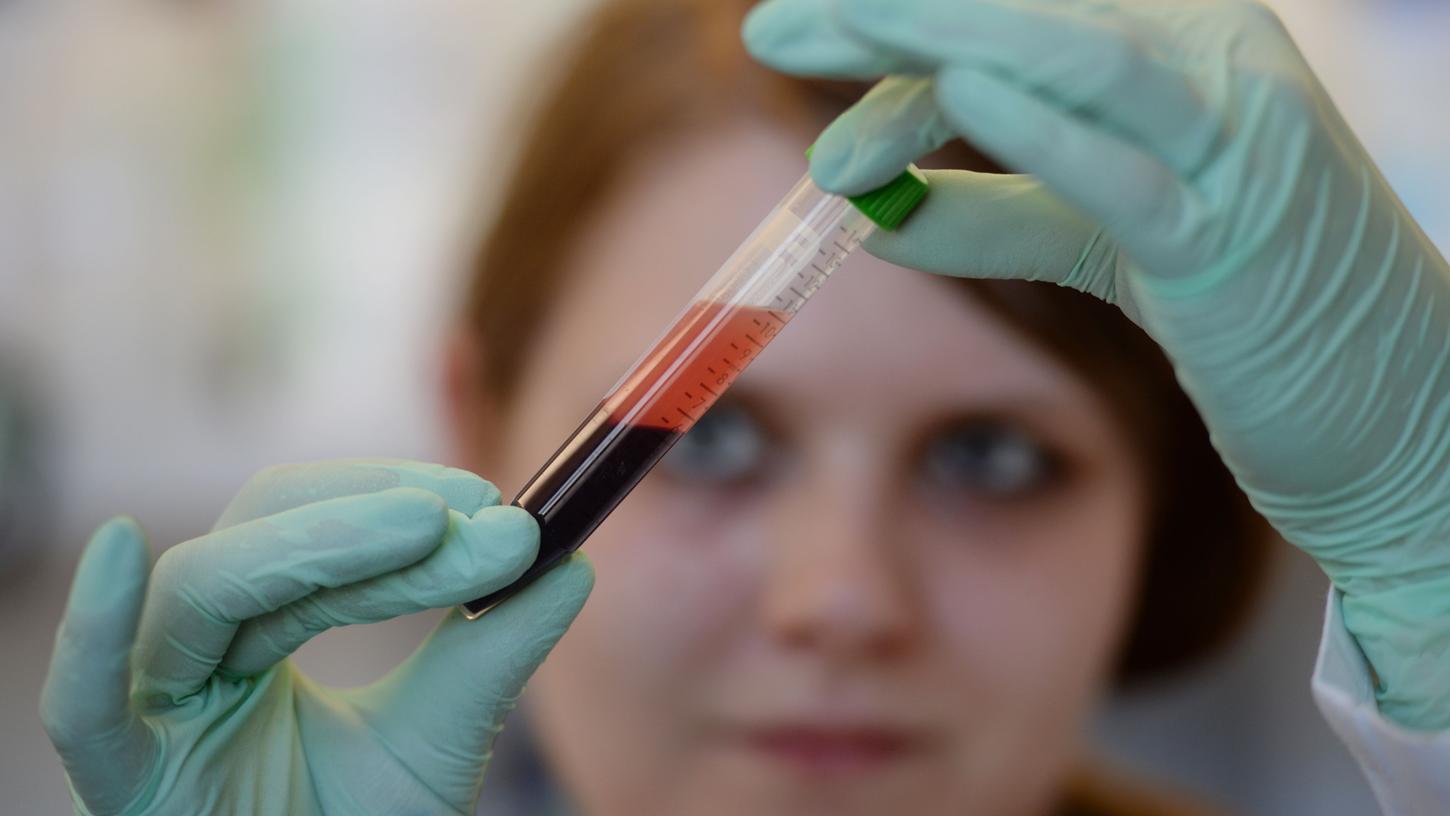 Der Bundestag debattiert am Donnerstag über Down-Syndrom-Bluttest als Kassenleistung.
