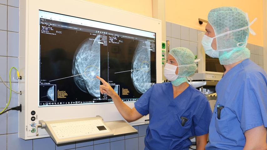 Brust Op Uniklinik Erlangen Liegt Im Nz Klinikcheck Vorne Erlangen Nordbayern De