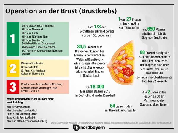 Brust-OP: Uniklinik Erlangen liegt im NZ-Klinikcheck vorne