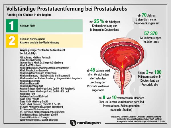 NZ-Klinikcheck: Das sind die Experten bei Prostatakrebs