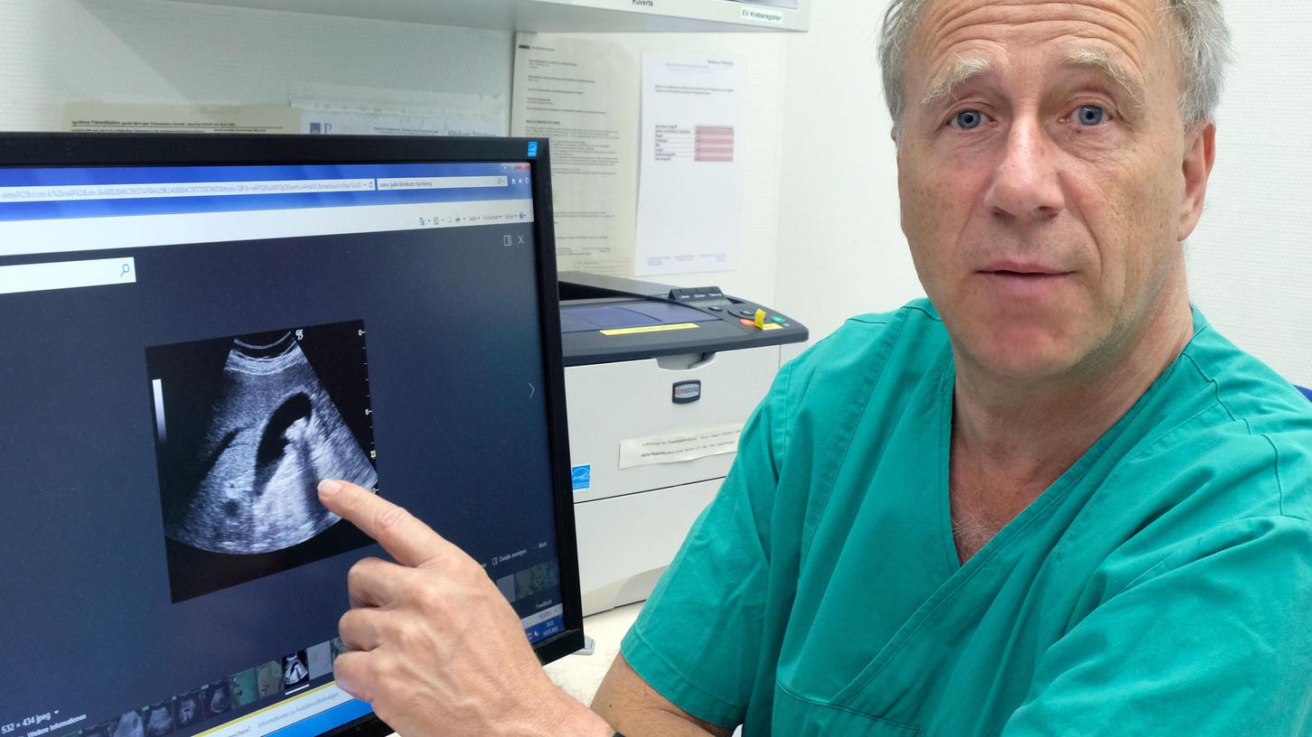 Prof. Dr. Hubert Stein zeigt das Ultraschallbild einer Gallenblase.