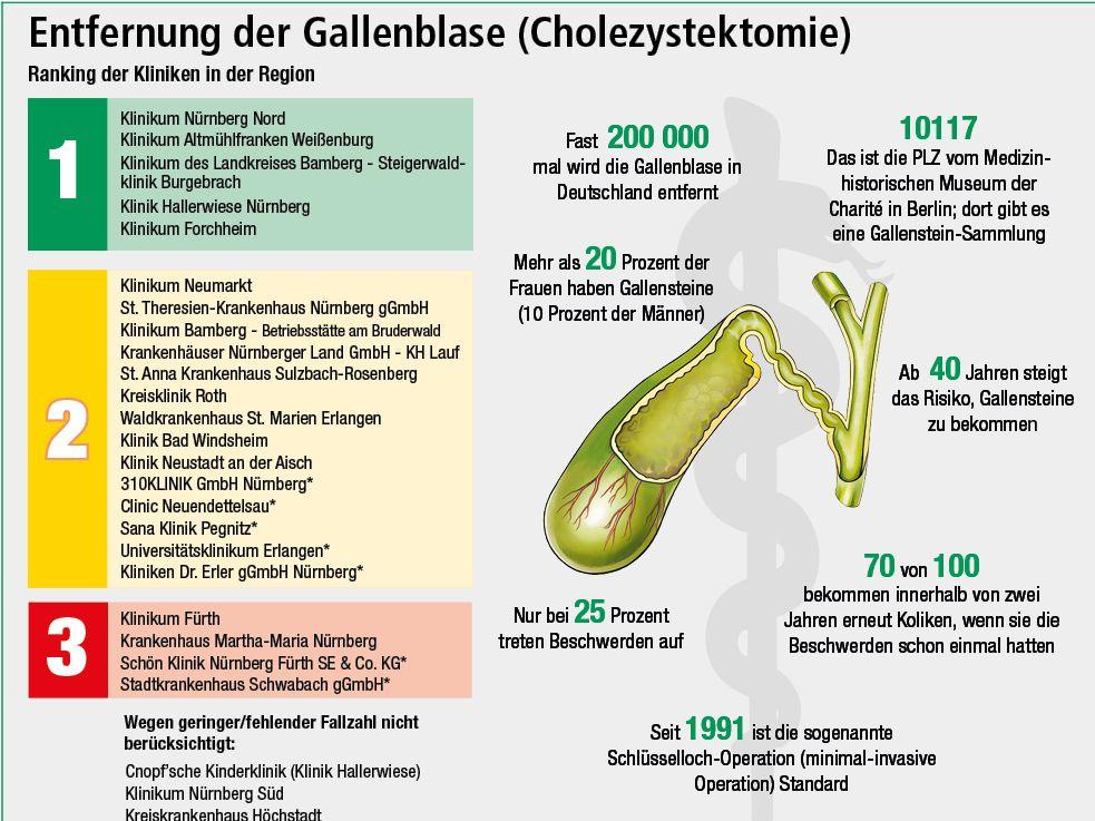 Gallenblasen-OP: Nordklinikum liegt beim NZ-Klinikcheck vorn