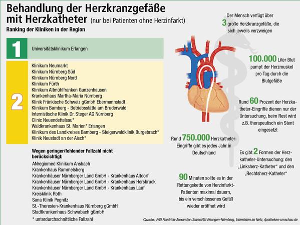 NZ-Klinikcheck: Herzkatheter - Uniklinikum Erlangen liegt vorn 
