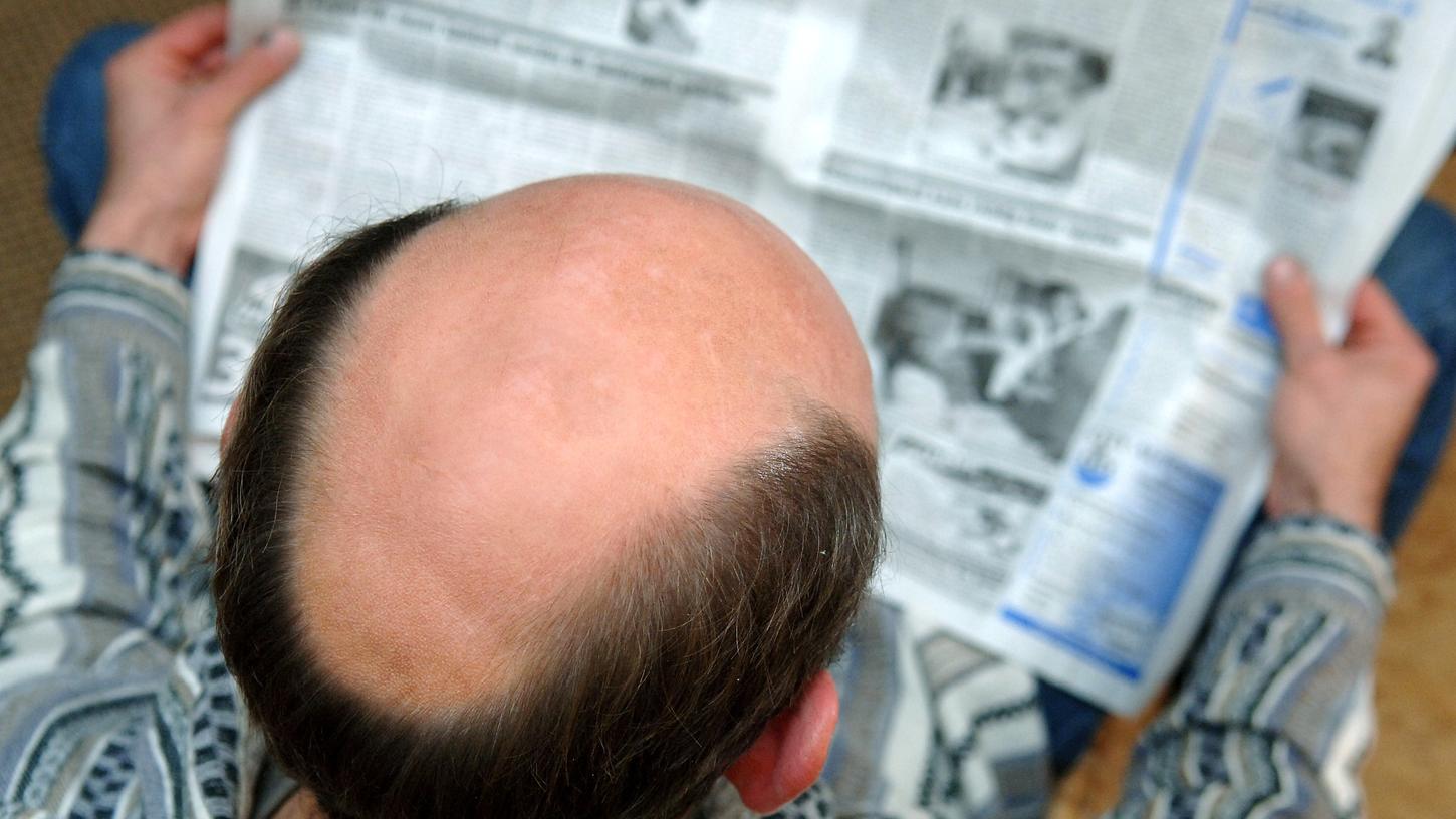 Vor allem bei Männern setzt der Haarausfall teilweise schon in jüngeren Jahren ein.