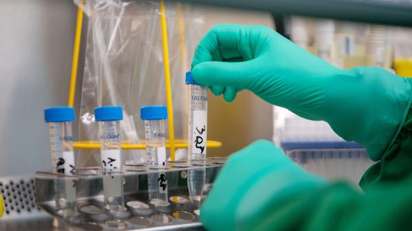 Das Coronavirus hält Deutschland und die Welt weiterhin in Atem. Zahlreiche Corona-Maßnahmen sind im vergangenen Jahr bereits umgesetzt worden - dabei ist es auch weiterhin wichtig Hygienemaßnahmen einzuhalten. Wir haben neun Hygiene- und Verhaltens-Tipps nach Empfehlungen der Weltgesundheitsorganisation (WHO) zur Vorbeugung des Coronavirus und anderen Virusinfektionen zusammengefasst.