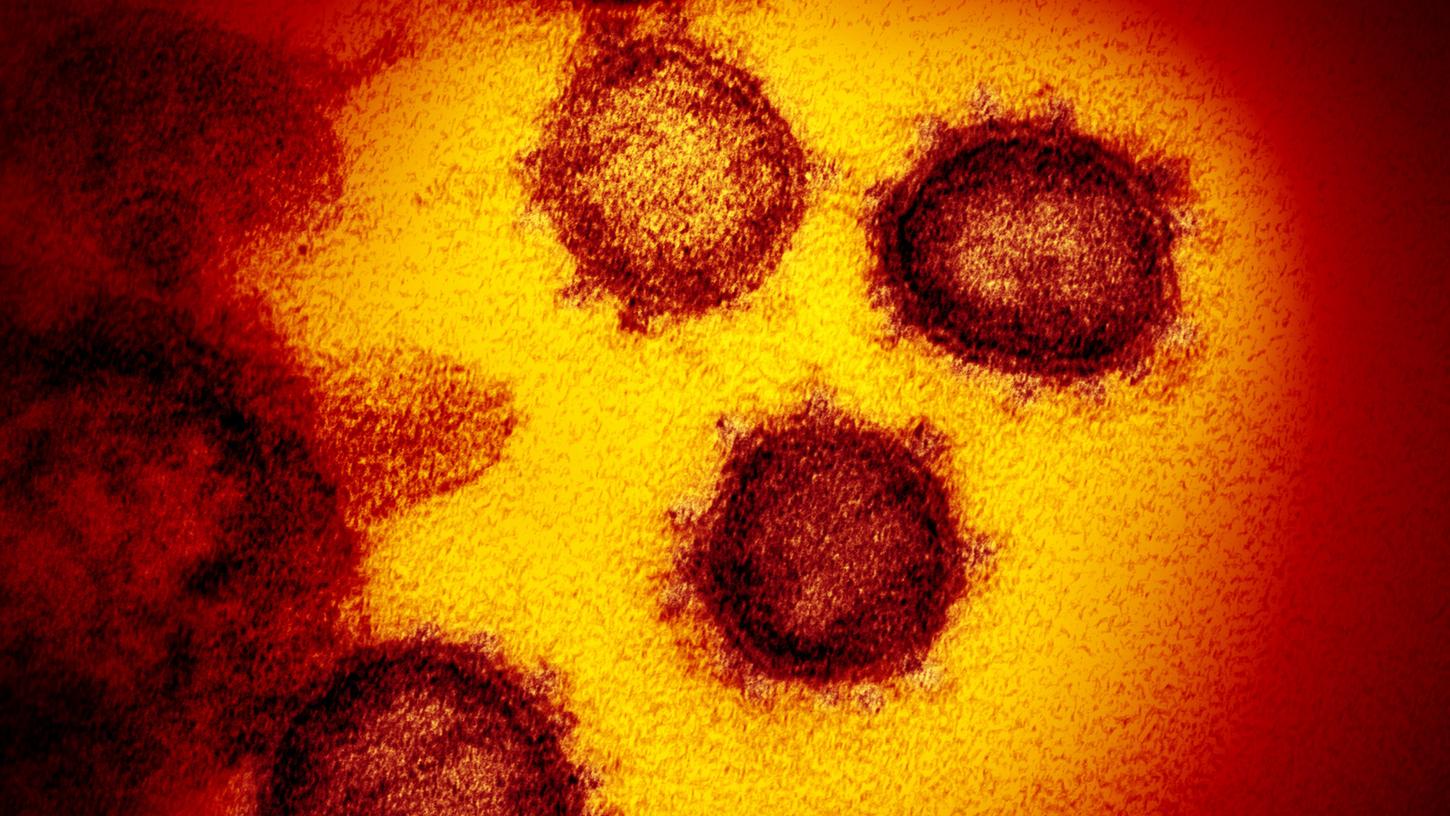 Das Coronavirus unter einem Mikroskop (Symbolbild).