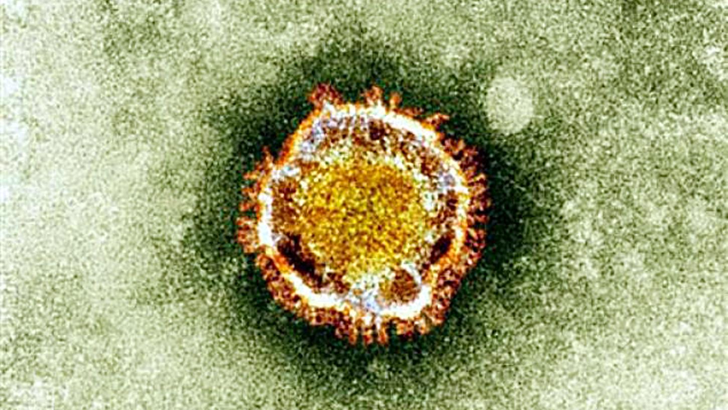 Das Coronavirus sieht unter dem Mikroskop ganz groß aus, dabei lässt es sich mit dem bloßen Auge nicht erkennen.