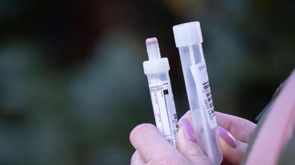 Im Kampf gegen Corona werden die Tests zum Nachweis des Virus immer effizienter. Ab November soll es in einem ersten mobilen Labor möglich sein, dass Ergebnisse von Corona-Tests bereits nach drei Stunden vorliegen. Bisher wurden hierfür bis zu 48 Stunden benötigt.